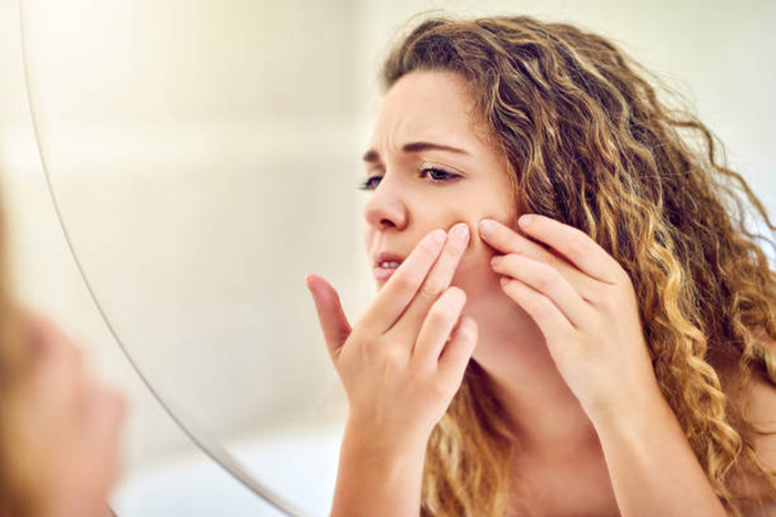 Should You Pop Those Pimples? | Phelps Health