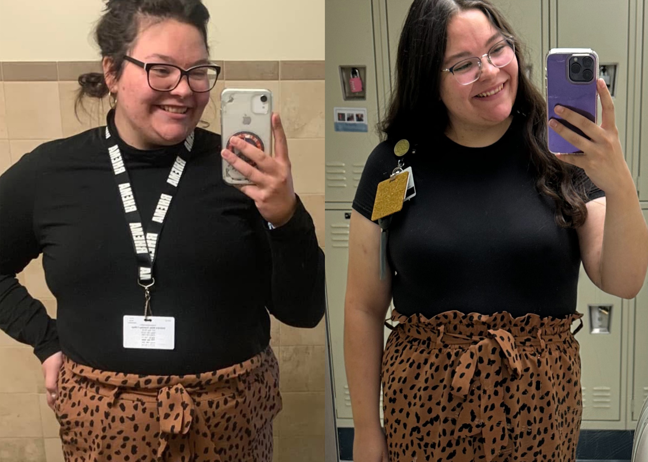 Emily Jones before and after bariatric surgery