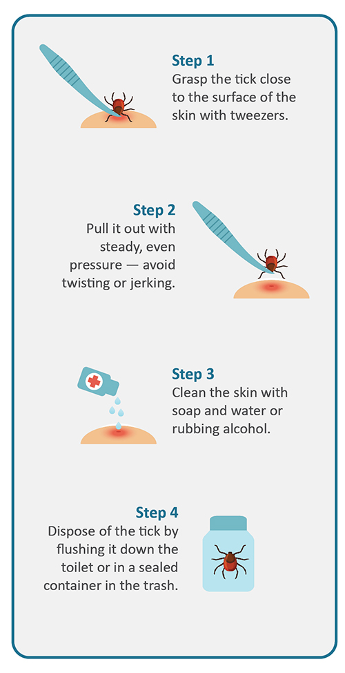 Tick removal tips