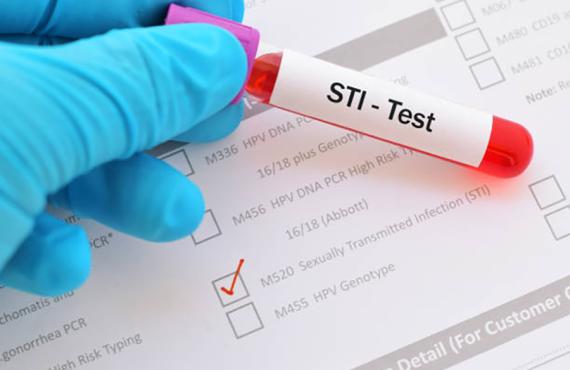 STI or STD test tube