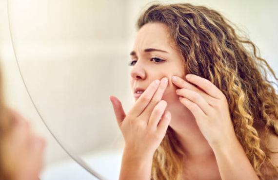 Girl looking a pimple acne in mirror