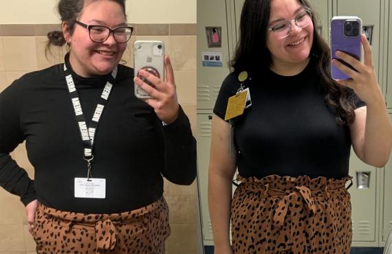 Emily Jones before and after bariatric surgery